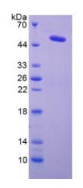 SDS-PAGE (LOX-7911H).jpg